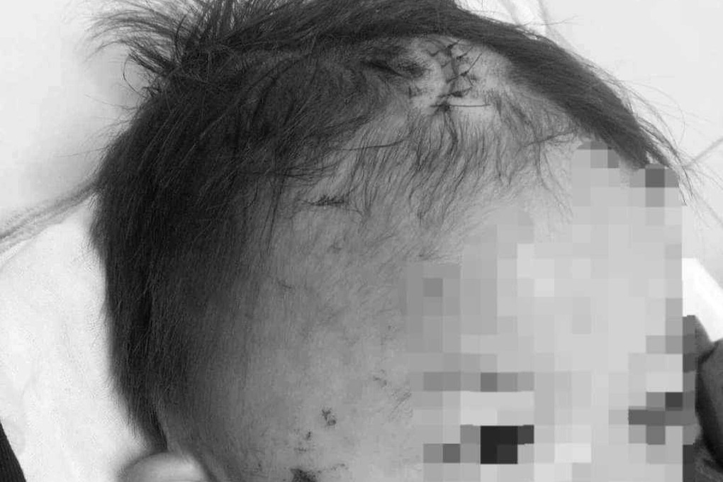 Công an xác minh tin bé 2 tuổi bị kẻ gây tai nạn ném vào bụi gây vỡ sọ - 1