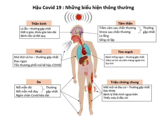 Các dấu hiệu nhận biết khi bị Covid 19 (Hình ảnh từ Internet)