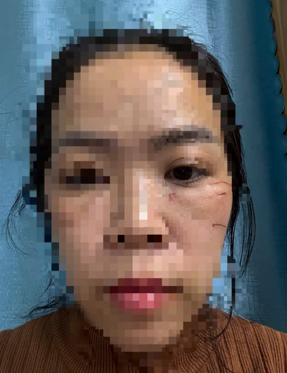 Ảnh 1