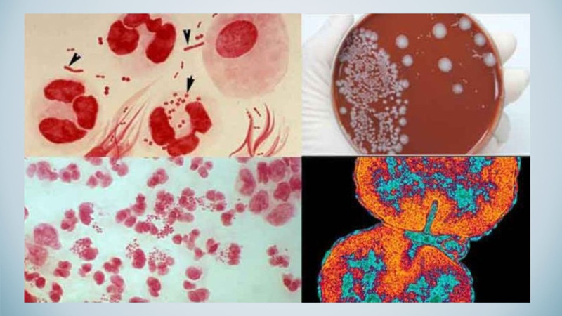 HPV type 59 thường trú trong lớp niêm mạc da hoặc các tế bào biểu mô của cơ quan sinh dục