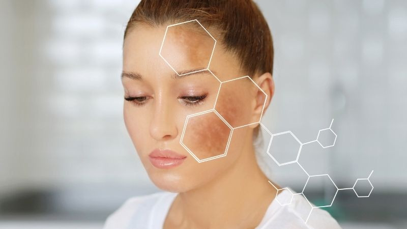 Melanin và sắc tố da là yếu tố quyết định màu da bề mặt