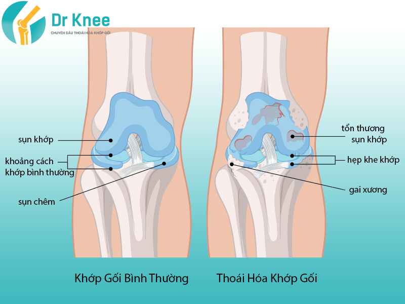 tải xuống