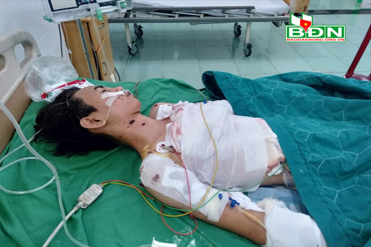 Bệnh viện Đa khoa Đắk Nông cứu thành công bệnh nhân bị thương nặng do nổ bình ga