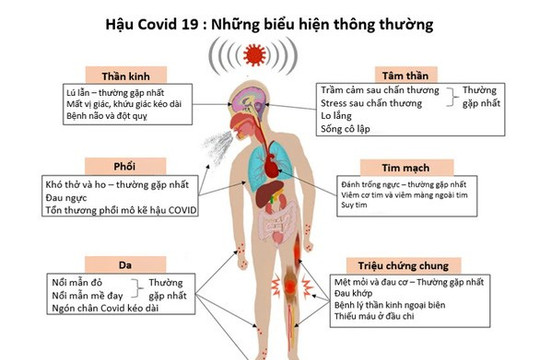 Các dấu hiệu nhận biết khi bị Covid 19