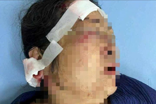 Truy tìm nhóm thanh niên hành hung 1 phụ nữ tại Phường Cam Ly-Đà Lạt