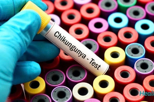 WHO cảnh báo nguy cơ lây lan cao của virus Chikungunya