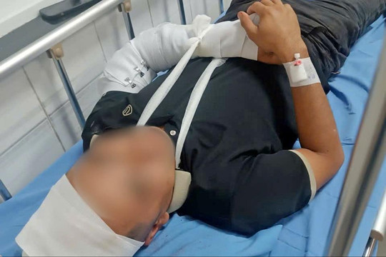 Điều tra vụ việc tài xế xe cứu hộ giao thông bị đánh gãy tay