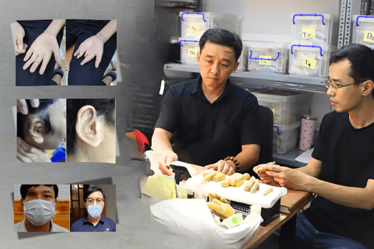 Đôi bạn Hà thành 'biến silicon thành da thịt' cho người khiếm khuyết