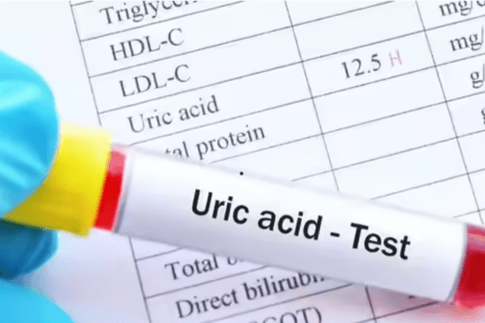 5 thực phẩm giúp giảm nồng độ axit uric nhanh chóng