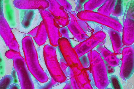 'Thuần hóa' vi khuẩn E. Coli để dệt và nhuộm vải đa sắc màu
