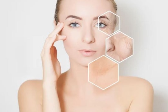 Những thói quen trong mùa lạnh khiến da lão hóa nhanh hơn