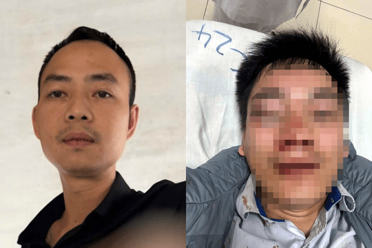 Công an Hà Nội truy tìm đối tượng hành hung tài xế xe buýt