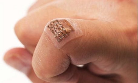 Nhu cầu thiết bị y tế đeo người vượt xa smartphone, cảnh báo tác động môi trường