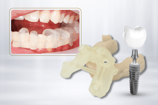 Nền tảng đánh giá nha khoa: Bước tiến mới trong lĩnh vực dịch vụ y tế tư nhân