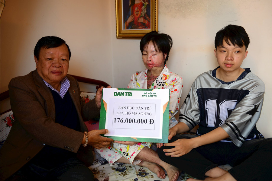 Trao 176 triệu đồng hỗ trợ bệnh nhân bị bỏng axit nặng ở Lâm Đồng