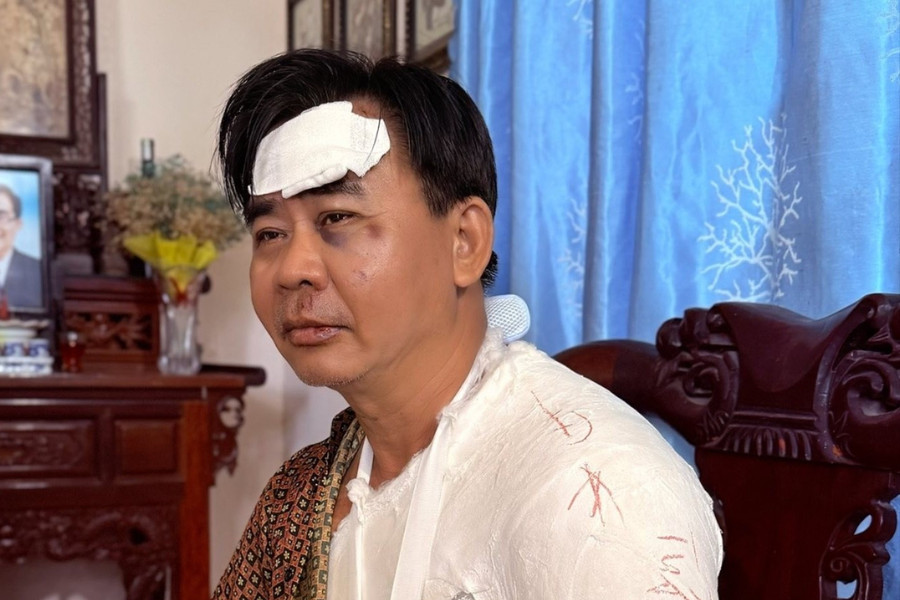Sức khỏe nghệ sĩ Chánh Thuận sau tai nạn: Gãy xương vai