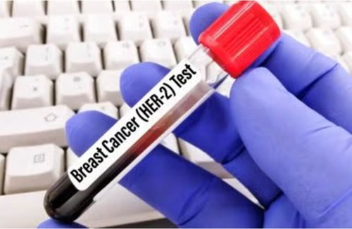 FDA ưu tiên xem xét đơn đăng ký thuốc giredestrant của Roche trong điều trị ung thư vú
