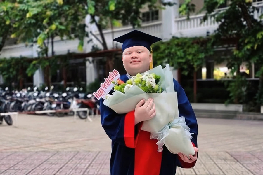 Chàng trai bạch tạng và hành trình chạm tới ước mơ