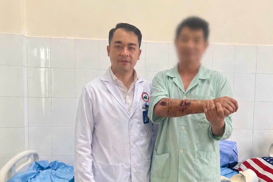 Bệnh viện Đa khoa Lâm Đồng: Nối thành công cẳng tay đứt gần lìa